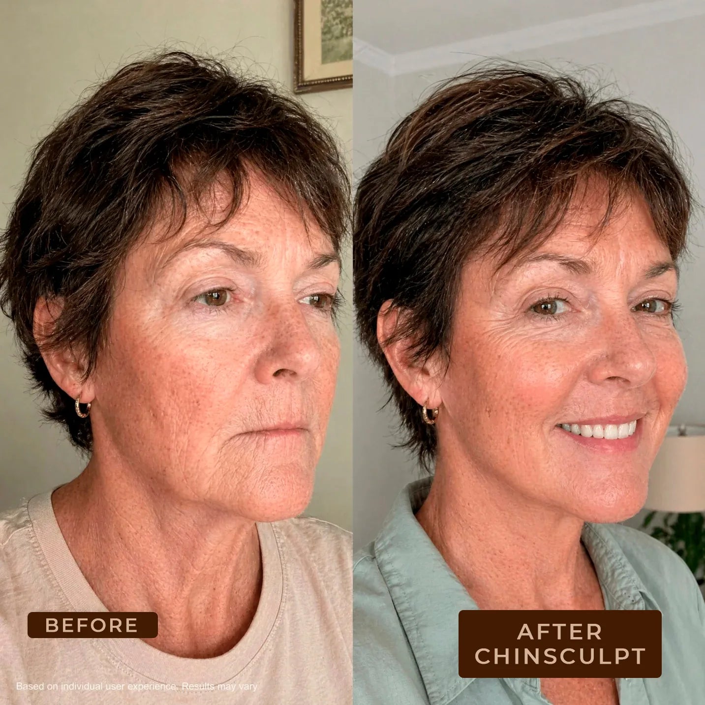 ChinSculpt - Jawline Contouring Mask