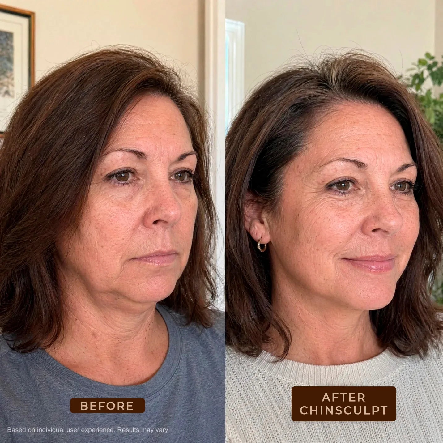 ChinSculpt - Jawline Contouring Mask