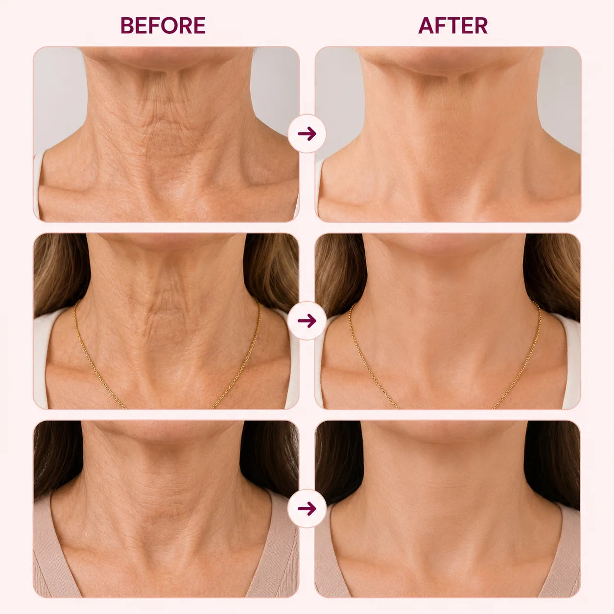 DermaNeck - Neck Firming & Anti-Wrinkle Patch