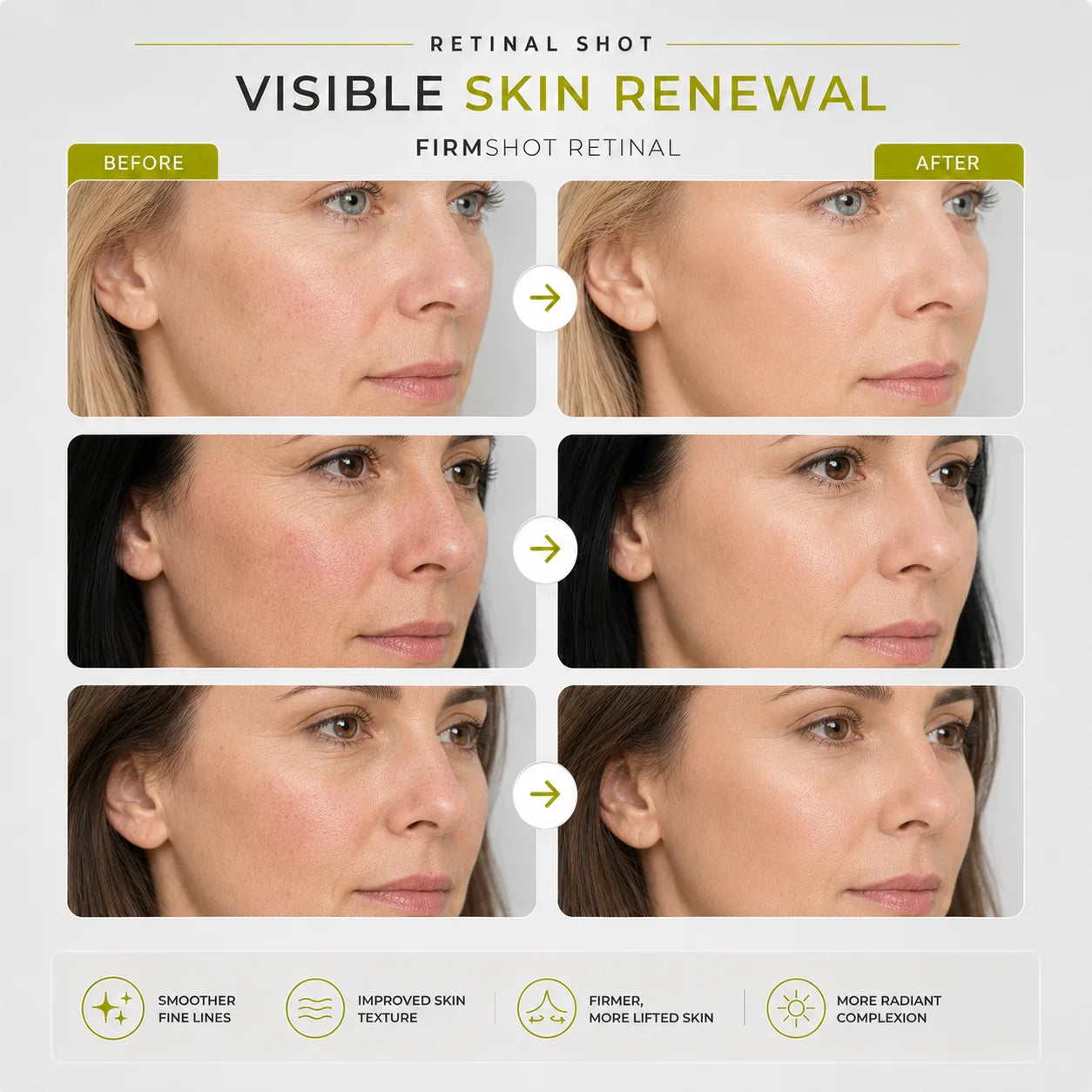 FirmShot Retinal - Visibly Firmer Skin in Just 2 Weeks